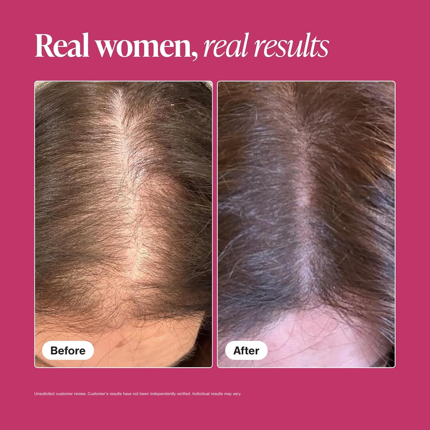 Vivical Hair Growth Supplements for Women, Thicker Fuller Hair Support for Thinning Hair and Hair Loss, with Biotin and Marine Collagen, Drug-Free, 180 Tablets, 90-Day Supply